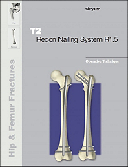 T2 Recon Nailing System